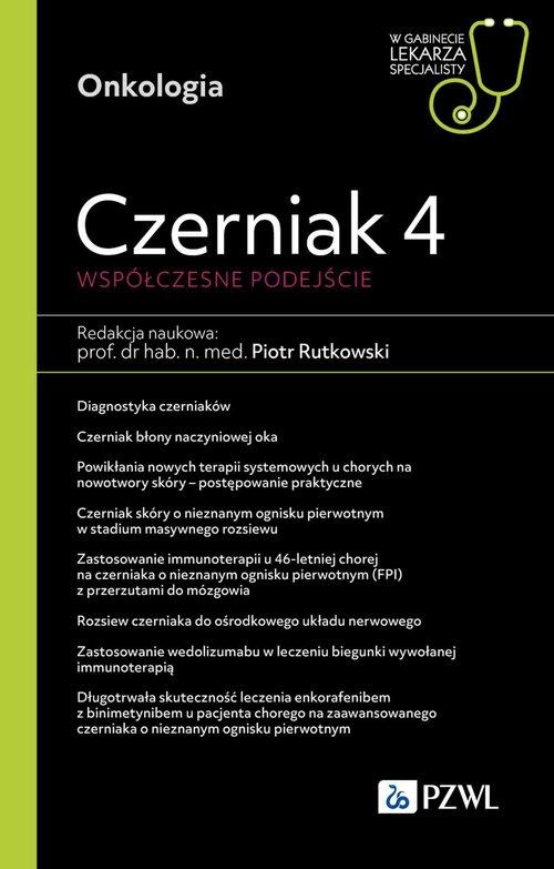 Czerniak 4 Współczesne podejście