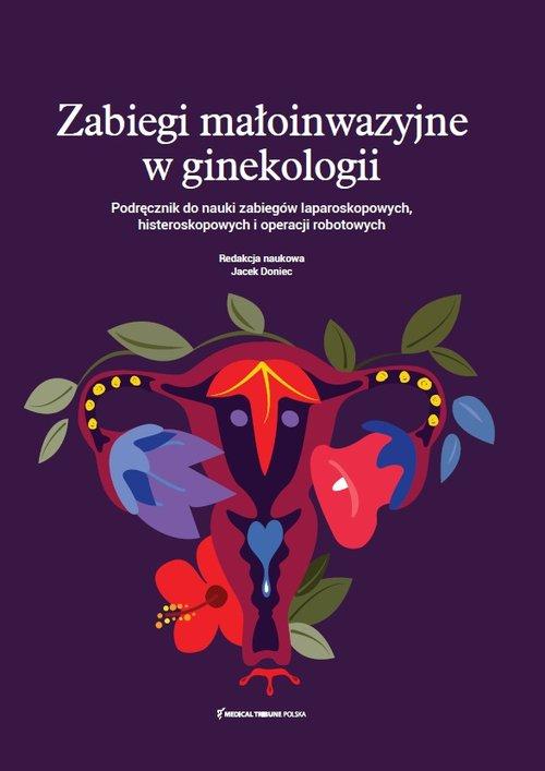 Zabiegi małoinwazyjne w ginekologii. Podręcznik do nauki zabiegów laparoskopowych histeroskopowych i operacji robotowych
