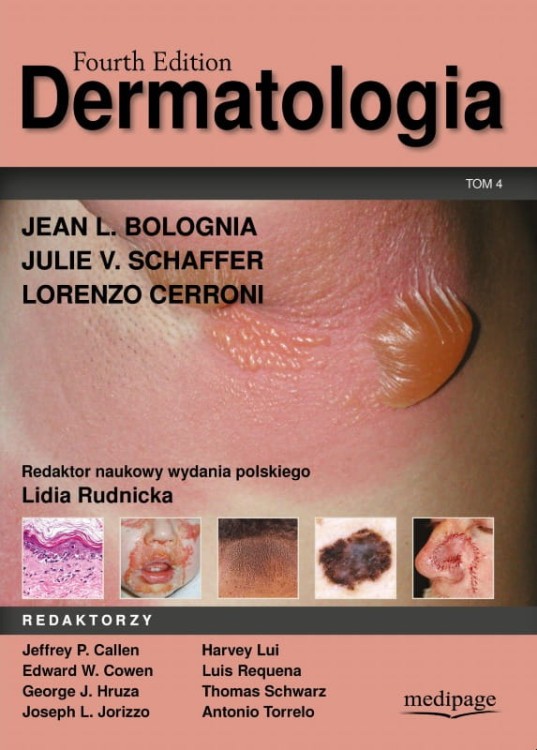 Dermatologia tom 4. Bolognia