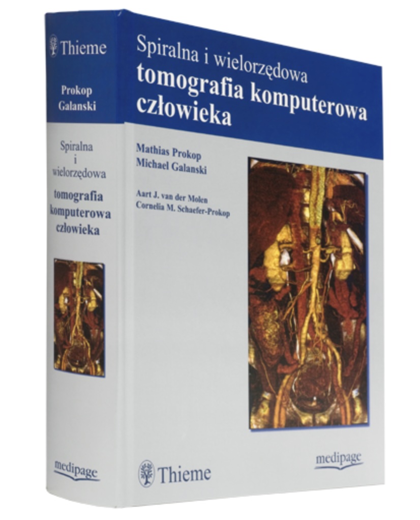 Spiralna i wielorzędowa tomografia komputerowa człowieka