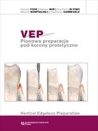 Vep pionowa preparacja pod korony protetyczne
