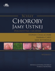Scully Choroby jamy ustnej Diagnostyka i leczenie
