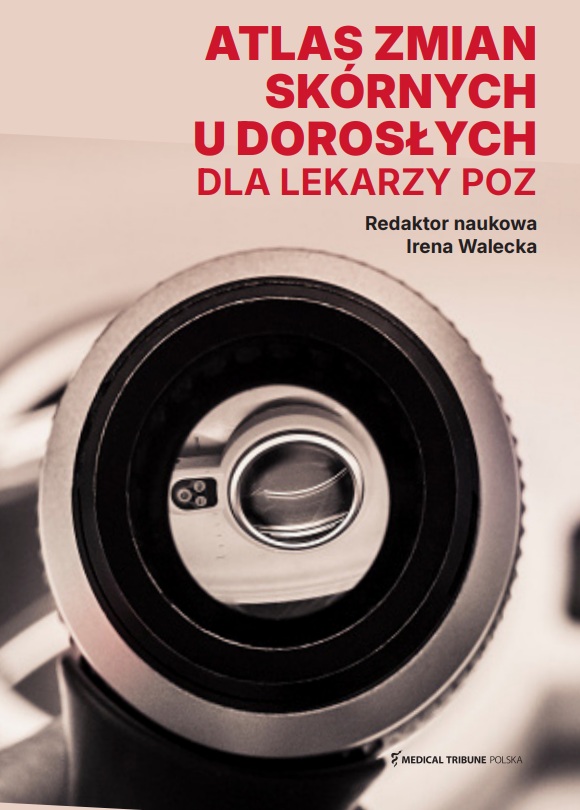 Atlas zmian skórnych u dorosłych dla lekarzy POZ