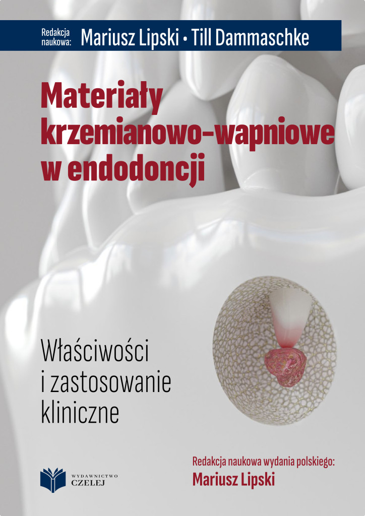 Materiały krzemianowo-wapniowe w endodoncji