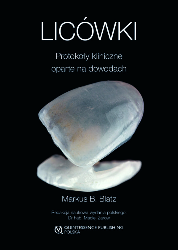 Licówki - Protokoły kliniczne oparte na dowodach