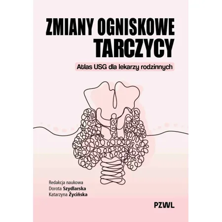 Zmiany ogniskowe tarczycy Atlas USG dla lekarzy rodzinnych
