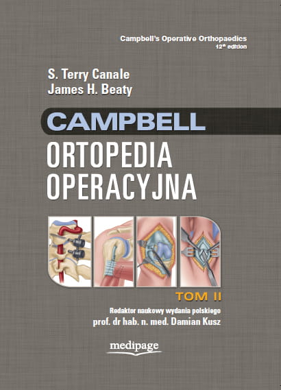 Campbell Ortopedia Operacyjna Tom 2