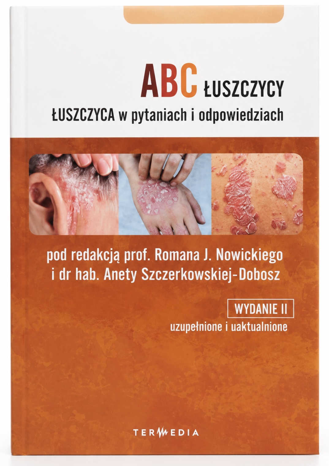 ABC Łuszczycy Łuszczyca w pytaniach i odpowiedziach